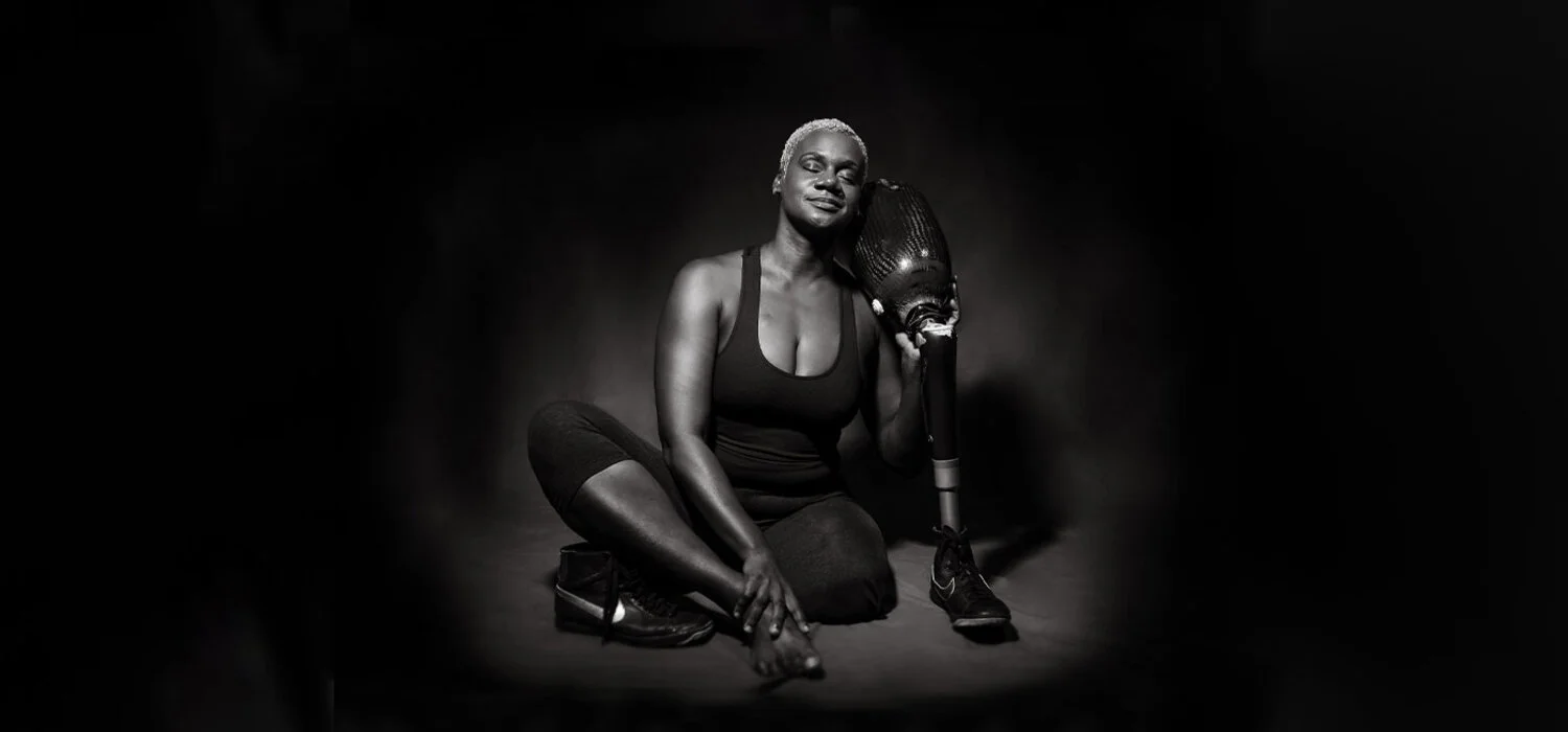 erin brown with prosthetic leg sitting