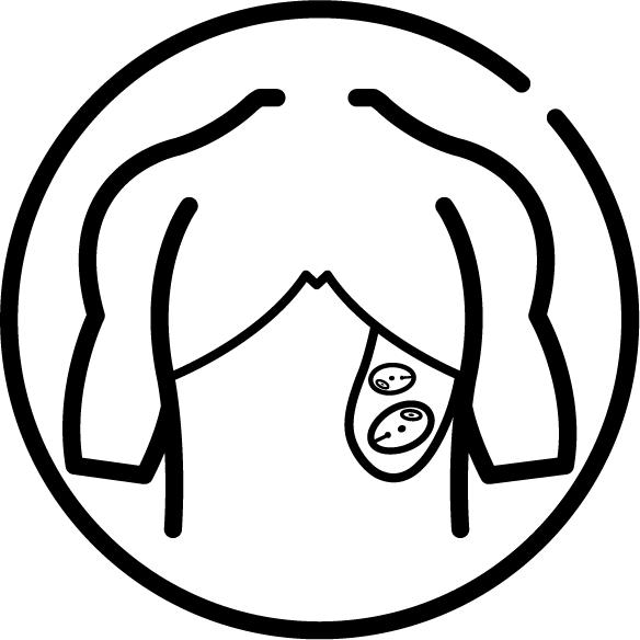 Vis