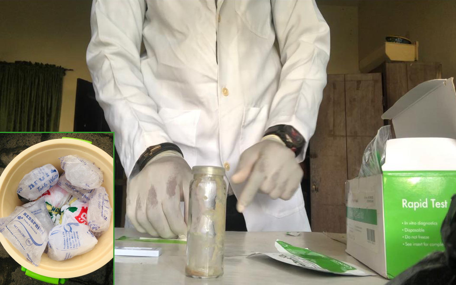 Collected brain samples are preserved in ice for transport to laboratory, while a rapid test kit enables immediate onsite rabies screening.