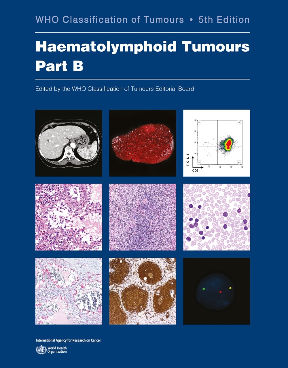 The WHO Classification of Tumours, Part B-thumbnail