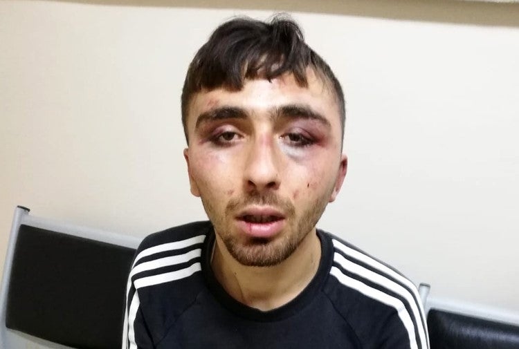 B.Y. alleges that in December 2019 police detained him and beat him while they were transferring him to a police station. © 2019 Private