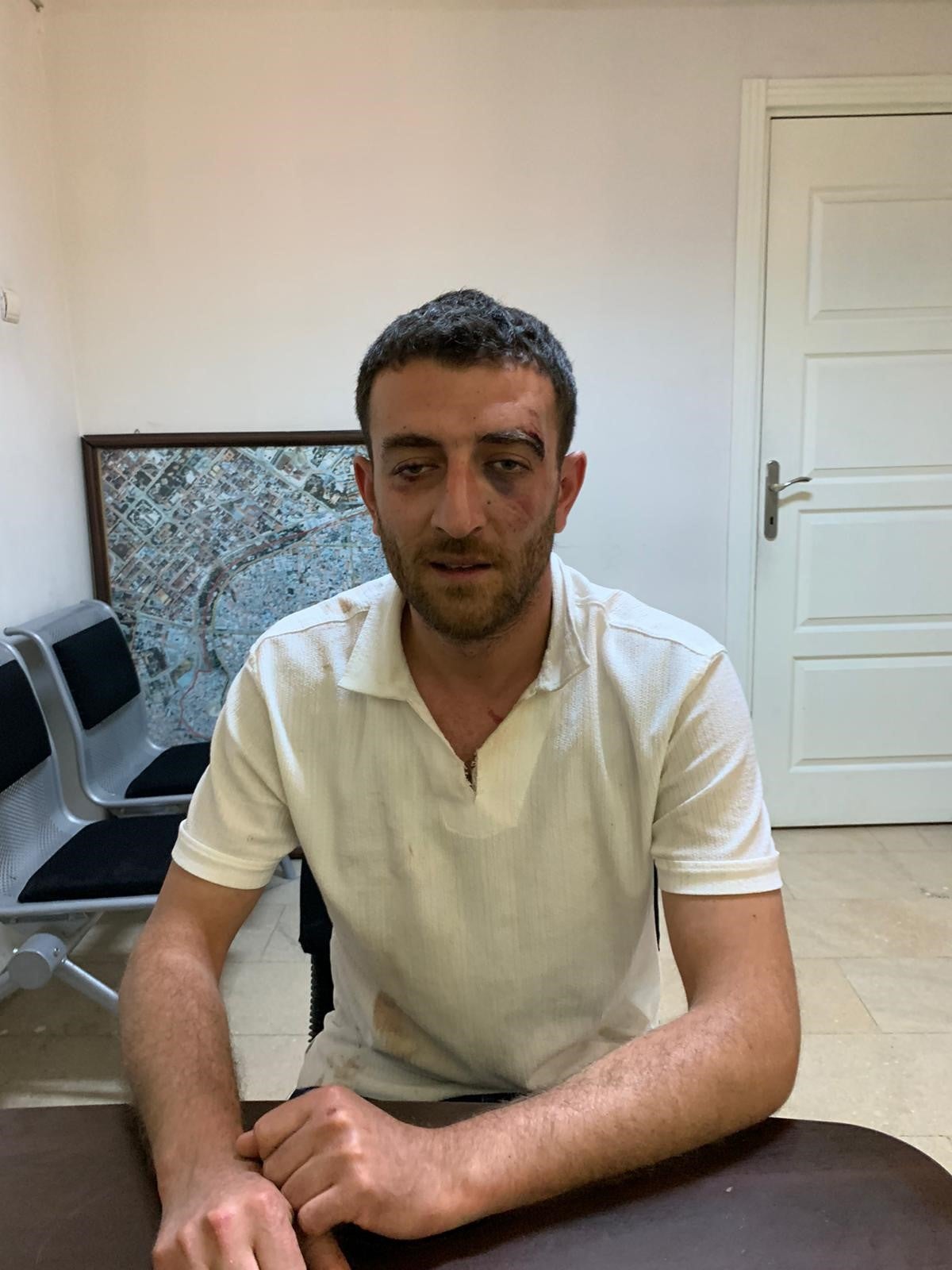 Koray Tosun alleges he was beaten by police officers before and during his custody.