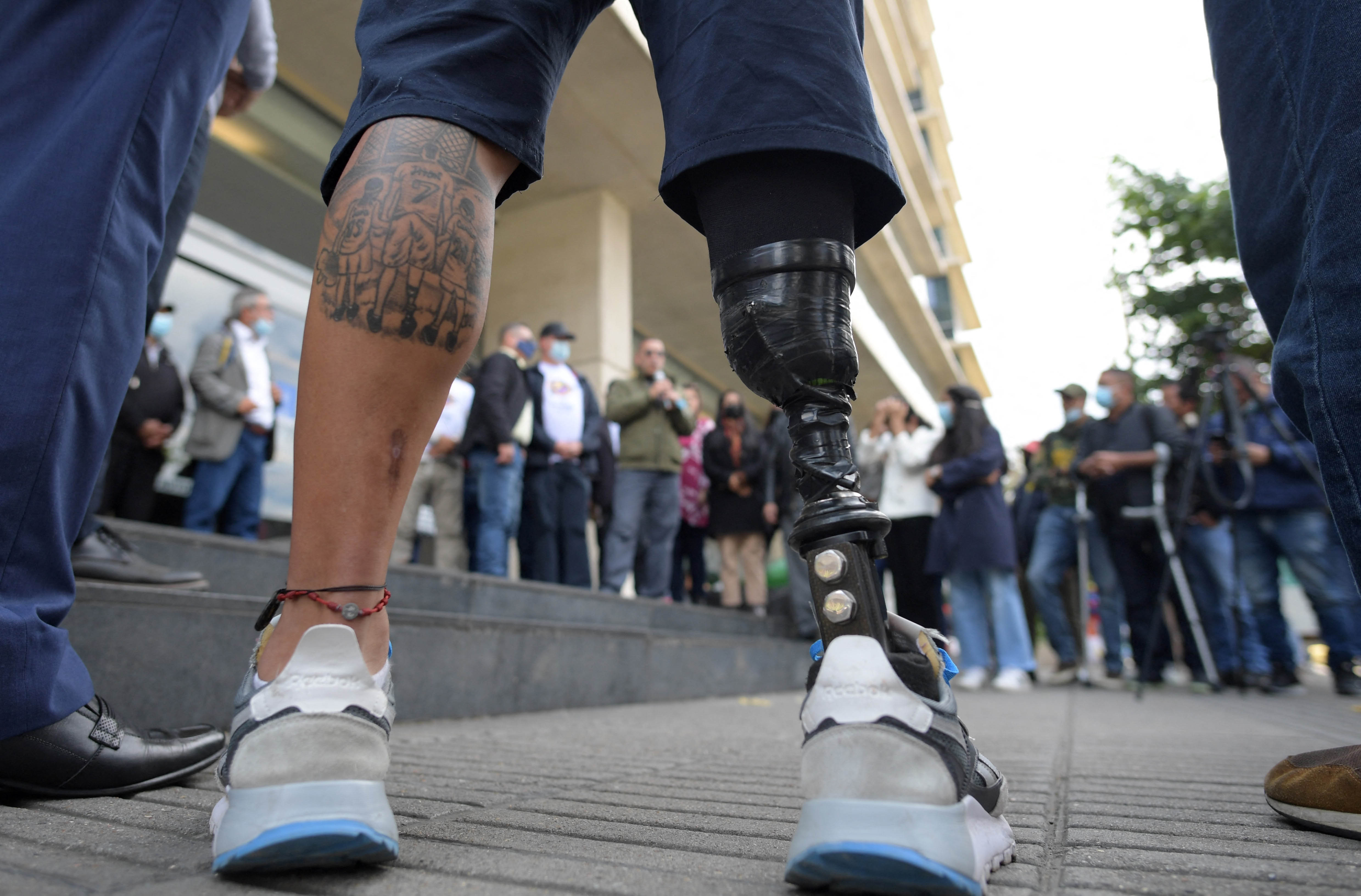 A landmine survivor wearing a prosthetic leg at an event to commemorate the International Day for Mine Awareness and Assistance in Mine Action in Bogotá, Colombia, April 4, 2022. Colombia is one of 164 countries that has prohibited antipersonnel landmines. 