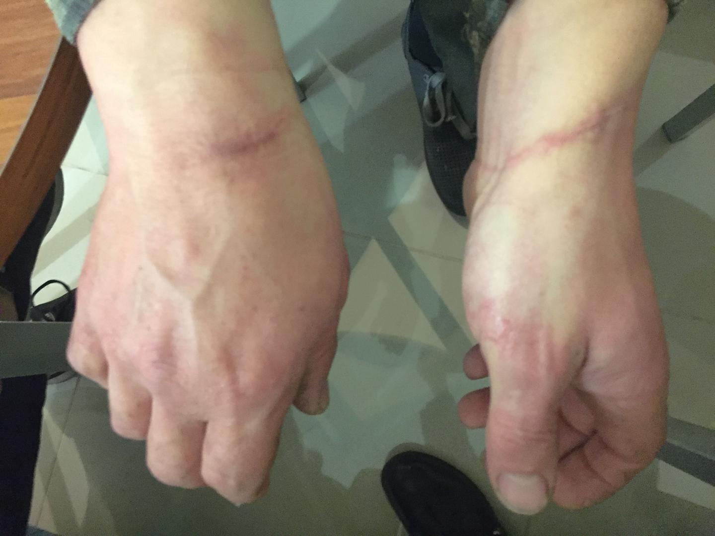 2016-11-28-eca-ukraine-donetsk-scars