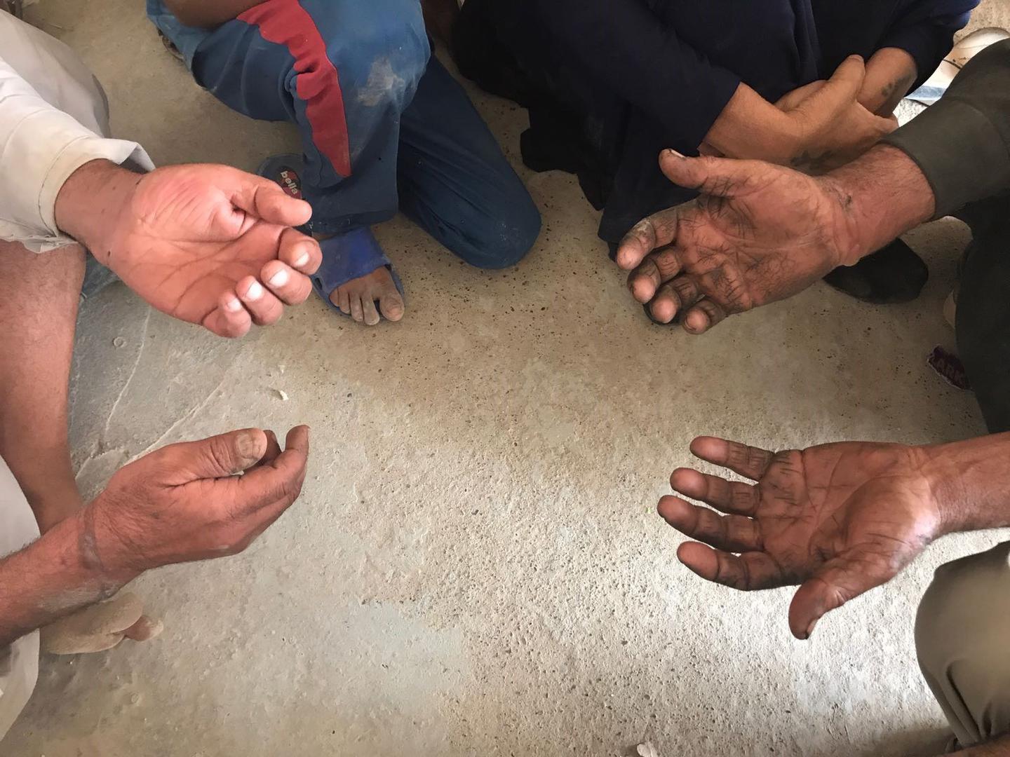 Two elderly men from Sayhat Othman village show researchers the blisters on their wrists caused by handcuffs.