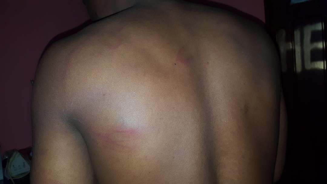 •	صورة هنري بعد تعرضه للضرب. © 2018 خاص 