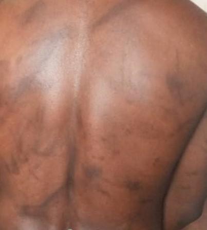 A suspected armed separatist, 46, said he was tortured at the State Defense Secretariat (SED) in Yaoundé, Cameroon, where he was held for six months in 2018.