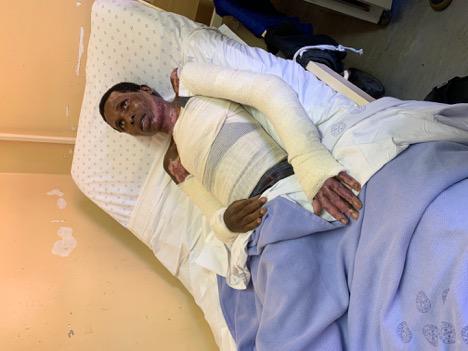 Foreign truck driver hospitalized after his truck was gasoline bombed in Durban while he slept in it, April 2019. The driver sustained severe injuries and remains in hospital at time of publication. © Human Rights Watch 2019