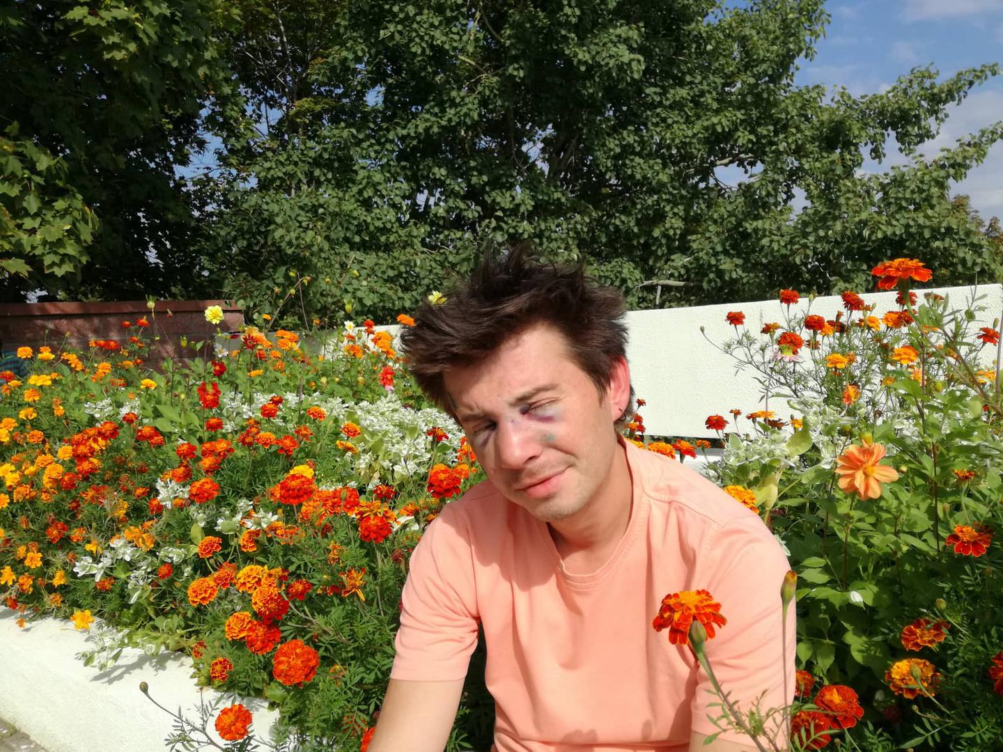 Nikolai Kuprich after the attack.