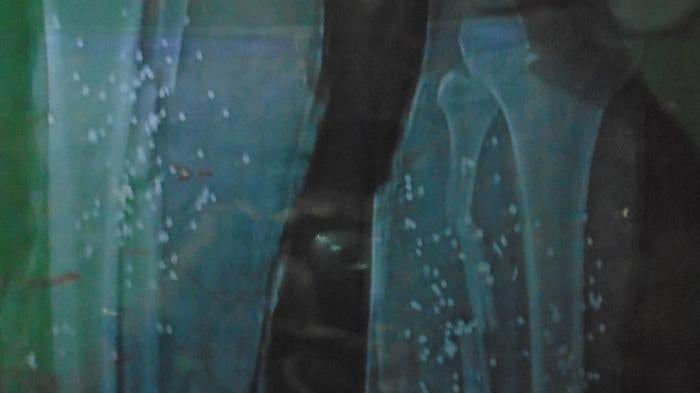 A photo of an X-ray showing bullets penetrating a bone.