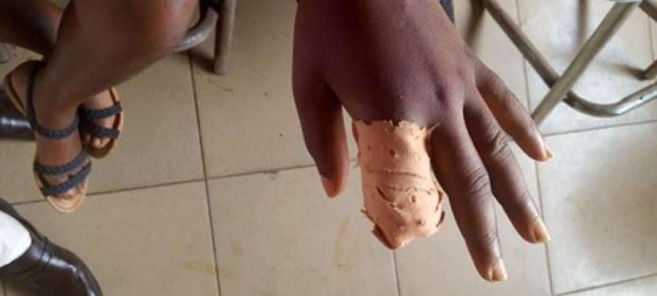 Close-up shot of a hand with a bandage wrapped around one finger