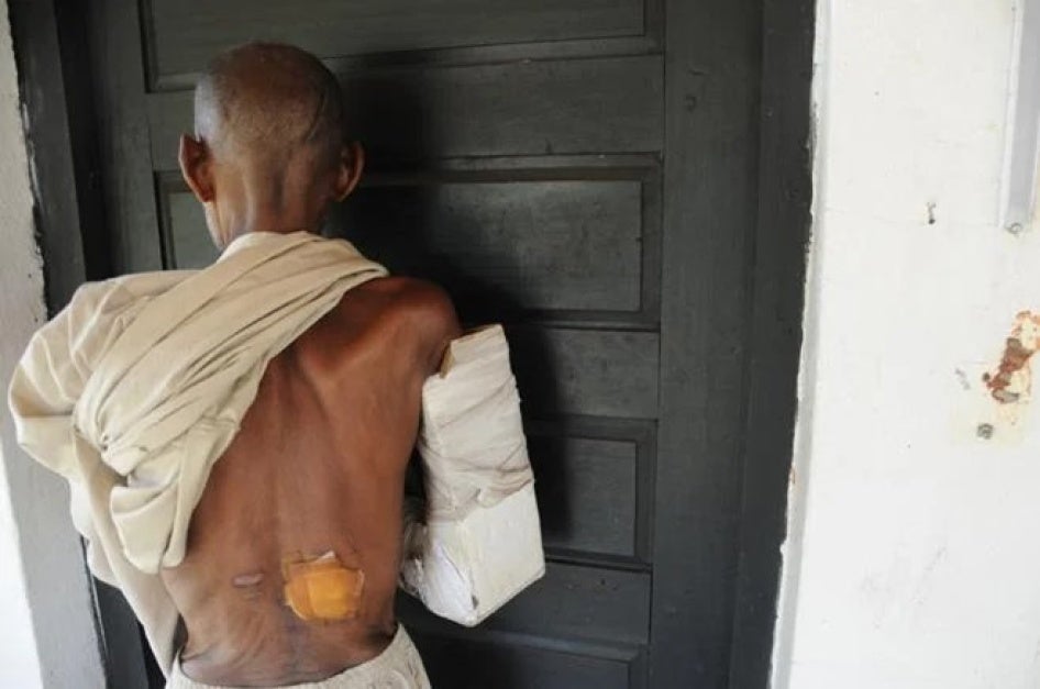 Wounds of a victim of the February 1, 2014 anti-balaka attack on Guen.