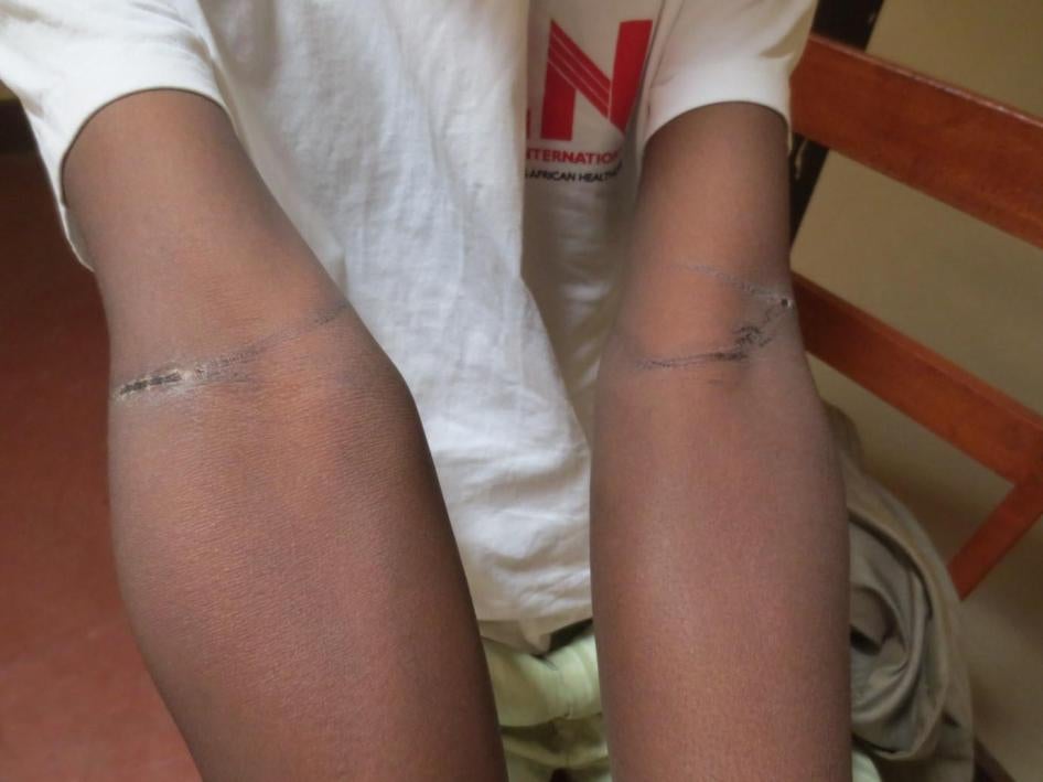 Des Imbonerakure (membres de la ligue des jeunes du parti au pouvoir) ont agressé cet homme de 35 ans, ancien membre de leur parti, le 2 juillet 2015. Ils lui ont attaché les bras dans le dos, l’ont frappé avec des bâtons et ont tenté de l’étrangler.  