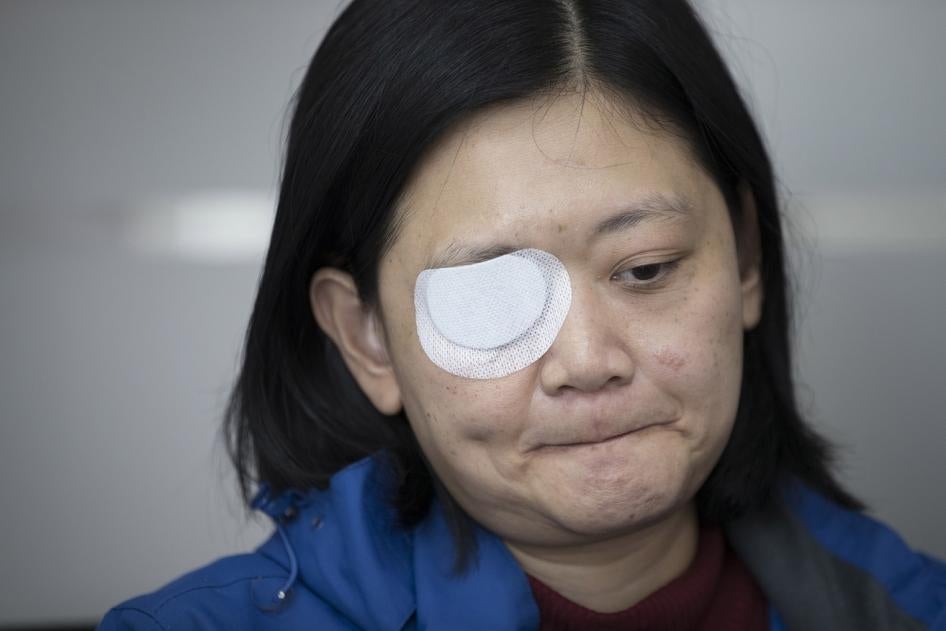 In this Wednesday, Dec. 4, 2019, photo, Veby Mega Indah, an injured Indonesian video journalist, bites her lips during an interview with The Associated Press in the Wan Chai area of Hong Kong.