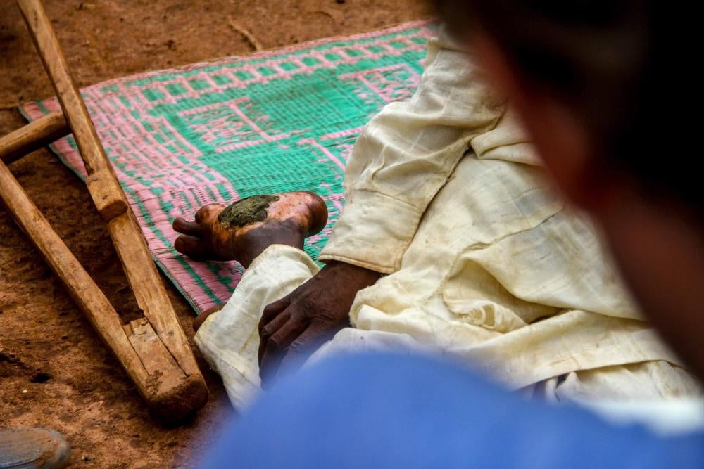Anti-balaka fighters shot and wounded “Salé,” a 42-year-old Peuhl man, during an attack near Ngakobo in early 2015. “I knew that if there was another attack I would not be able to run,” he said from the l’Élêvagé camp in Bambari.