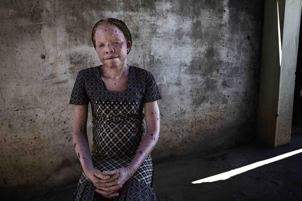 202001AFR_Mozambique_photo01