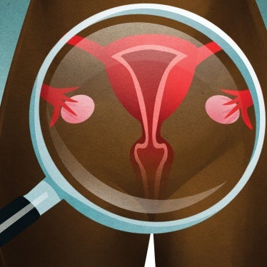 202201us_georgia_cervicalcancer_screening_illustration