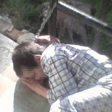 Screenshot of a resident in the Trubchevsk psycho-neurological institution in the Briansk region chained to a metal frame.